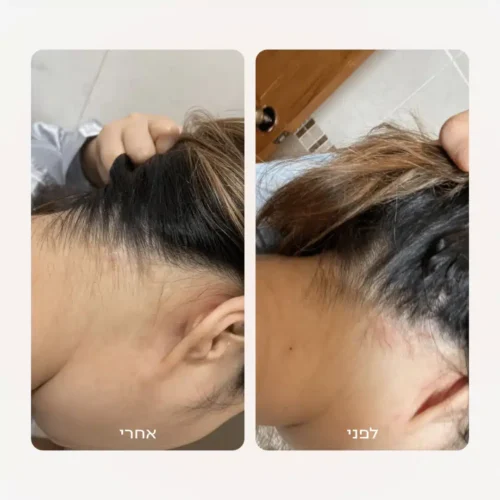 Alternative view of קרם טיפולי לקרקפת רגישה |Kamedis SCALP CONTROL